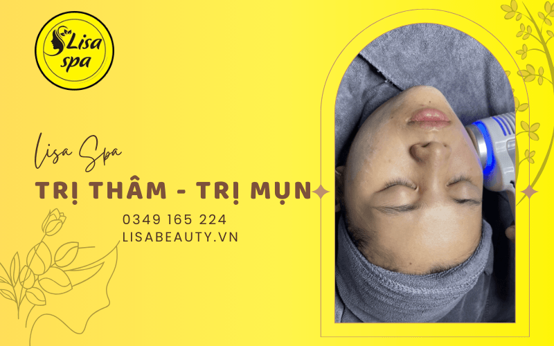 trị mụn trị thâm